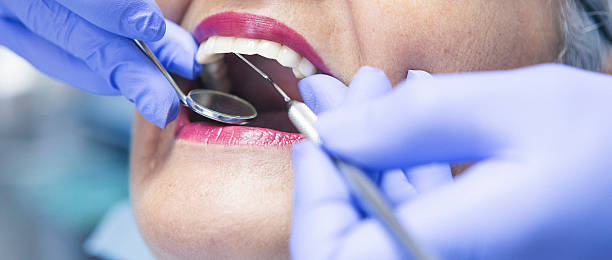 Best Emergency Dental Care for Broken or Chipped Teeth in Kingston, RI